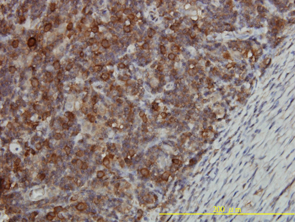 2 - CCT5 Antibody (monoclonal) (M01) AT1428a