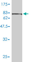 1 - CCT5 Antibody (monoclonal) (M01) AT1428a