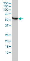 1 - CCT5 Antibody (monoclonal) (M01) AT1428a