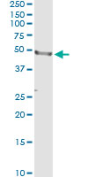 5 - CD177 Antibody (monoclonal) (M01) AT1431a