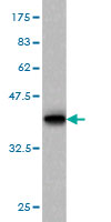 1 - CDKL4 Antibody (monoclonal) (M03) AT1480a