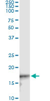 5 - CDKN2D Antibody (monoclonal) (M08) AT1483a