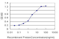 10 - CENPJ Antibody (monoclonal) (M01) AT1494a