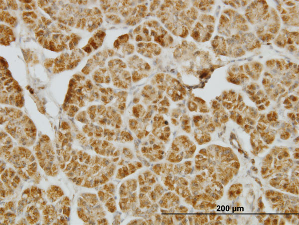 2 - CENPJ Antibody (monoclonal) (M01) AT1494a