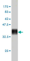 1 - CENPJ Antibody (monoclonal) (M01) AT1494a