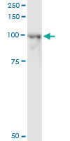 5 - CENTB2 Antibody (monoclonal) (M01) AT1495a