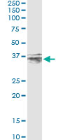 5 - CER1 Antibody (monoclonal) (M04) AT1496a