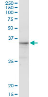 5 - CGREF1 Antibody (monoclonal) (M01) AT1510a