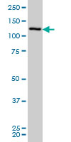 1 - CHERP Antibody (monoclonal) (M01) AT1517a