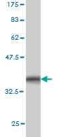 1 - CHST3 Antibody (monoclonal) (M01) AT1531a