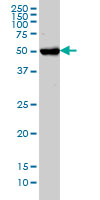 1 - CHST3 Antibody (monoclonal) (M01) AT1531a
