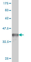 1 - CITED1 Antibody (monoclonal) (M01) AT1540a