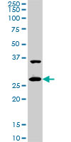 1 - CITED1 Antibody (monoclonal) (M01) AT1540a