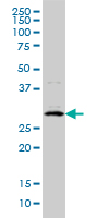 1 - CITED1 Antibody (monoclonal) (M01) AT1540a