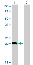 1 - CITED1 Antibody (monoclonal) (M01) AT1540a