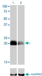 1 - CITED1 Antibody (monoclonal) (M01) AT1540a