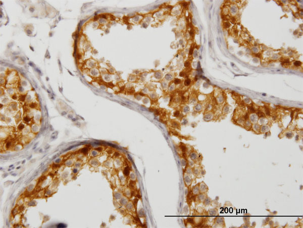 2 - CITED1 Antibody (monoclonal) (M03) AT1541a