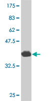 1 - CITED1 Antibody (monoclonal) (M03) AT1541a