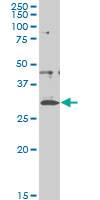 1 - CITED1 Antibody (monoclonal) (M03) AT1541a