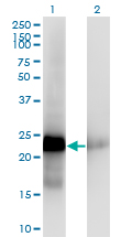 1 - CITED1 Antibody (monoclonal) (M03) AT1541a