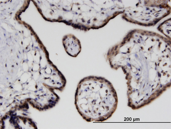 2 - CITED4 Antibody (monoclonal) (M08) AT1542a