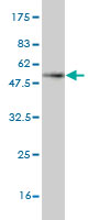 1 - CLEC4E Antibody (monoclonal) (M08) AT1556a