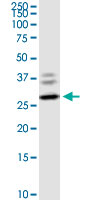 1 - CLEC4E Antibody (monoclonal) (M08) AT1556a
