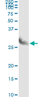 5 - CLIC3 Antibody (monoclonal) (M02) AT1557a