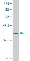 1 - CMTM5 Antibody (monoclonal) (M01) AT1567a