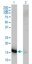 1 - CMTM5 Antibody (monoclonal) (M01) AT1567a