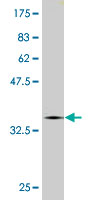 1 - CNOT2 Antibody (monoclonal) (M08) AT1571a