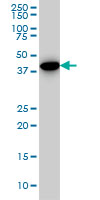 1 - CNOT2 Antibody (monoclonal) (M08) AT1571a