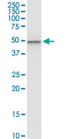 1 - CNOT2 Antibody (monoclonal) (M08) AT1571a