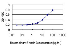 10 - COL4A6 Antibody (monoclonal) (M01) AT1583a