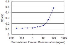 10 - COL5A1 Antibody (monoclonal) (M01) AT1584a