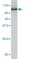 1 - COL5A1 Antibody (monoclonal) (M01) AT1584a
