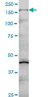 1 - COL5A1 Antibody (monoclonal) (M01) AT1584a