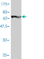 1 - COL6A2 Antibody (monoclonal) (M01) AT1585a