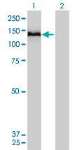 1 - COL6A2 Antibody (monoclonal) (M01) AT1585a