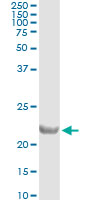 5 - COMMD1 Antibody (monoclonal) (M01) AT1586a