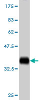 1 - COX17 Antibody (monoclonal) (M01) AT1597a