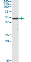 5 - CPA2 Antibody (monoclonal) (M02) AT1604a