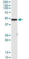 5 - CPB1 Antibody (monoclonal) (M01) AT1605a