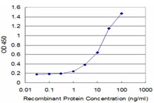10 - CRLF1 Antibody (monoclonal) (M02) AT1627a