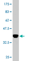 1 - CRLF1 Antibody (monoclonal) (M02) AT1627a