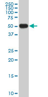 1 - CRLF1 Antibody (monoclonal) (M02) AT1627a