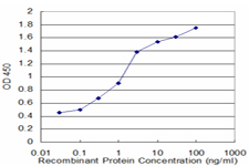 10 - CRYM Antibody (monoclonal) (M09) AT1646a