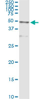 5 - CTSD Antibody (monoclonal) (M01) AT1680a