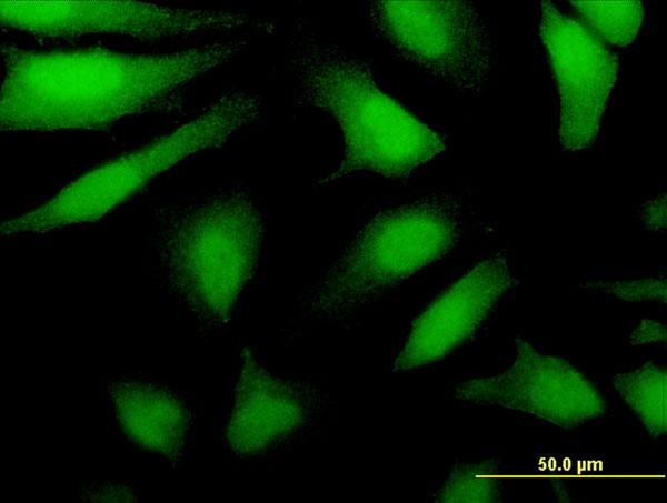 3 - DDX43 Antibody (monoclonal) (M07) AT1737a
