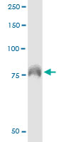 5 - DEF6 Antibody (monoclonal) (M01) AT1749a